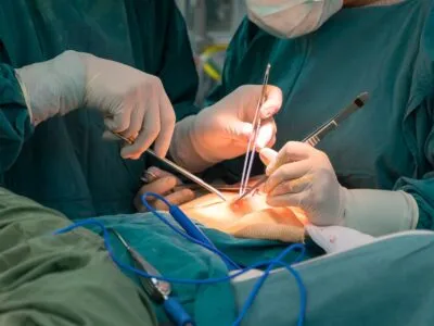 General Surgery