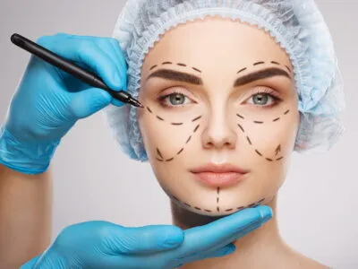 Plastic Surgery