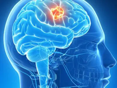 Neuro Surgery